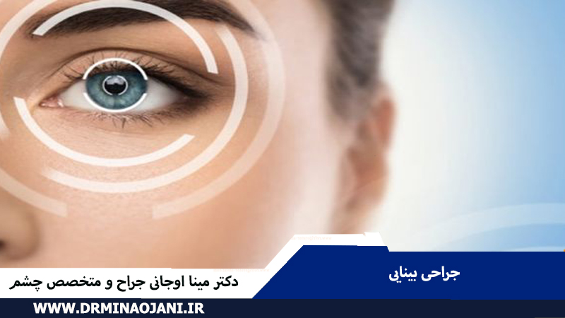 انواع جراحی بینایی