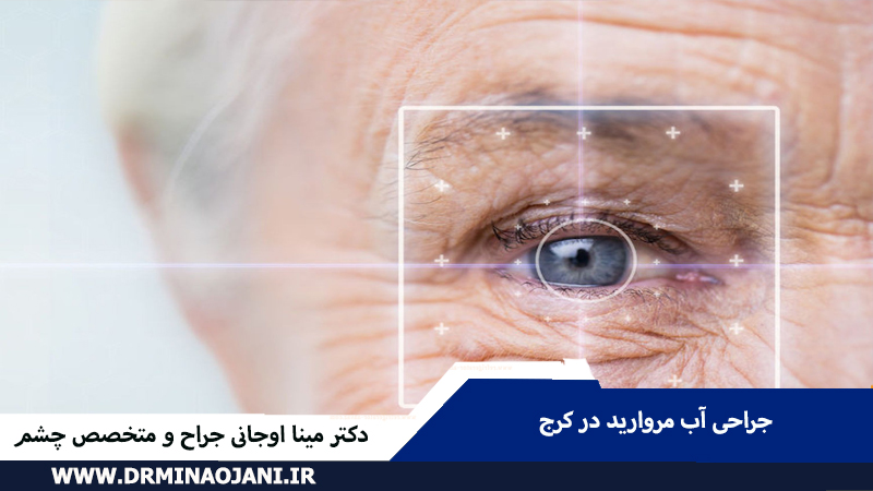 جراحی آب مروارید در کرج