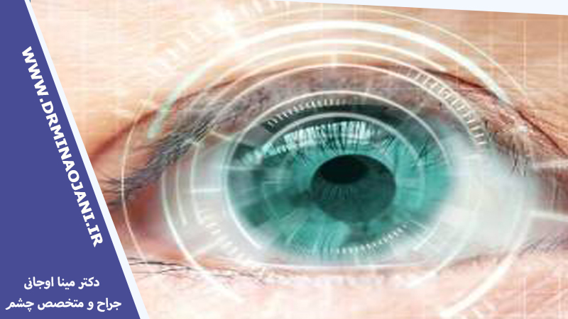 اگر در حین جراحی لیزر چشم پلک بزنید چه اتفاقی می افتد؟