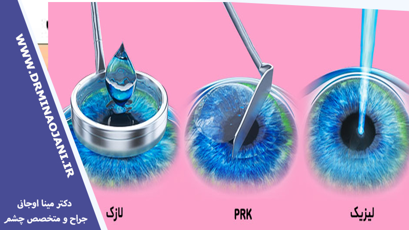 لیزیک، لازک یا PRK: کدام نوع از جراحی لیزر چشم برای شما بهترین است؟