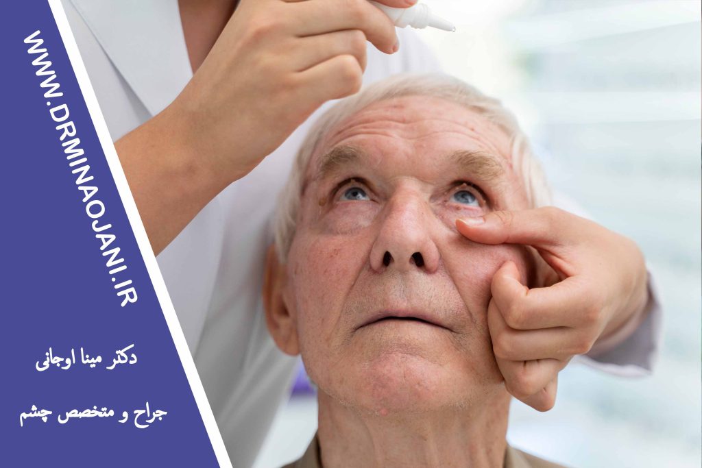 مراقبت پس از عمل جراحی چشم