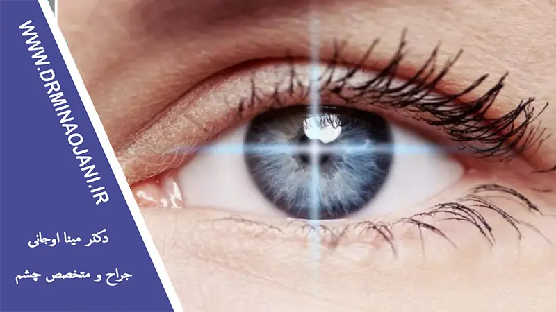 پیشگیری از آستیگماتیسم با روش‌های طبیعی