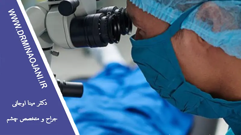 لیزر درمانی برای کاهش فشار چشم