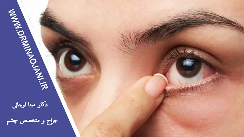 چگونه بیماری دیابت می‌تواند بر روی بینایی تاثیر بگذارد؟