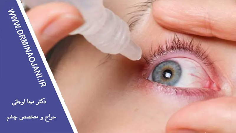 نکاتی که باید بعد از جراحی چشم رعایت کنید