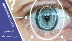 بررسی خواص گیاهان دارویی برای درمان مشکلات بینایی
