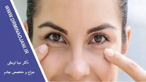 چگونه از سلامت چشم‌های خود مراقبت کنیم