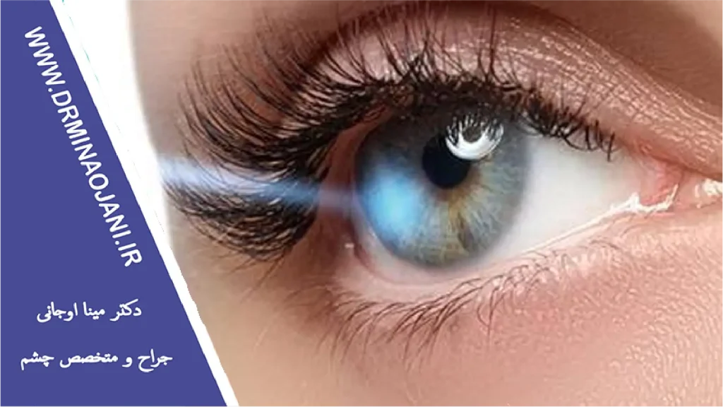علائم پارگی شبکیه چشم