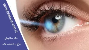 علائم پارگی شبکیه چشم