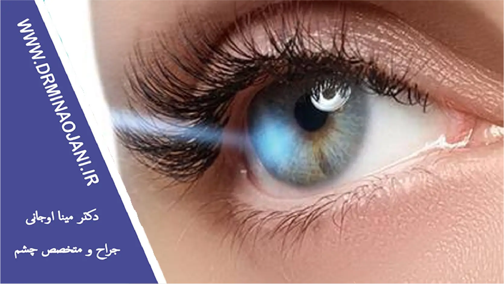 علائم پارگی شبکیه چشم